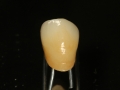 Zirconia 001